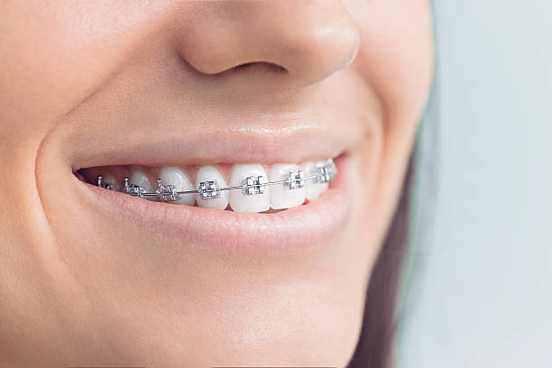 Best Wisdom Tooth Removal  in Rayne, LA